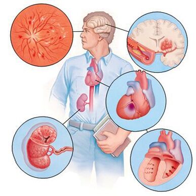 Cardiol prévient le développement de maladies concomitantes